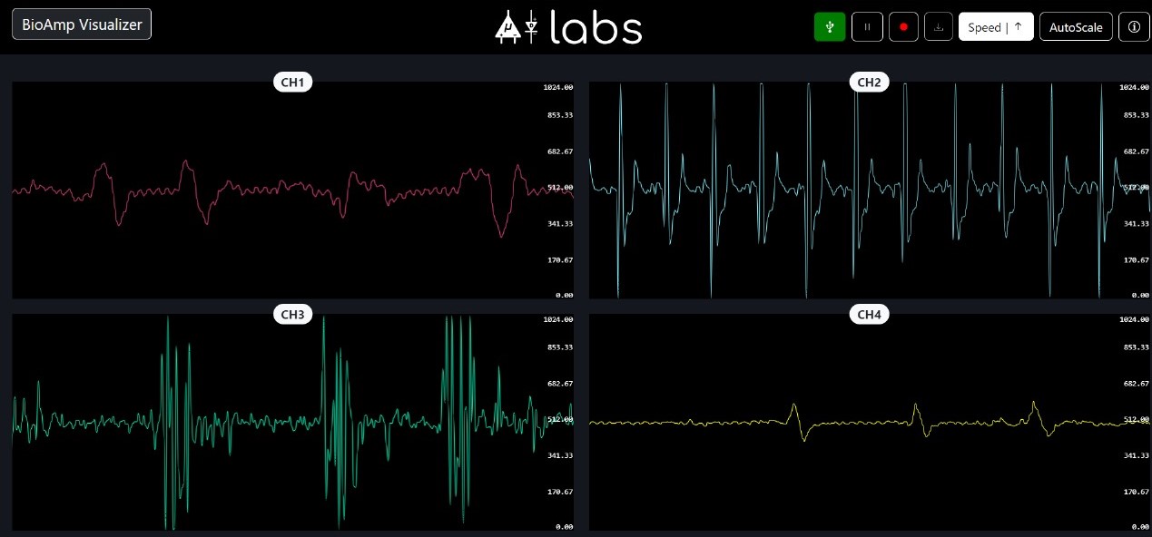 BioAmp Visualizer signal