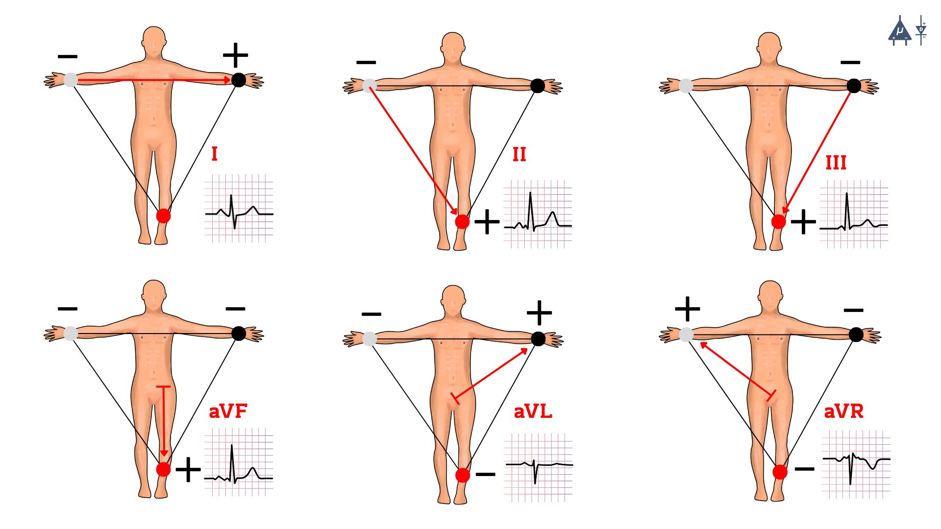 ECG Hexaxial System
