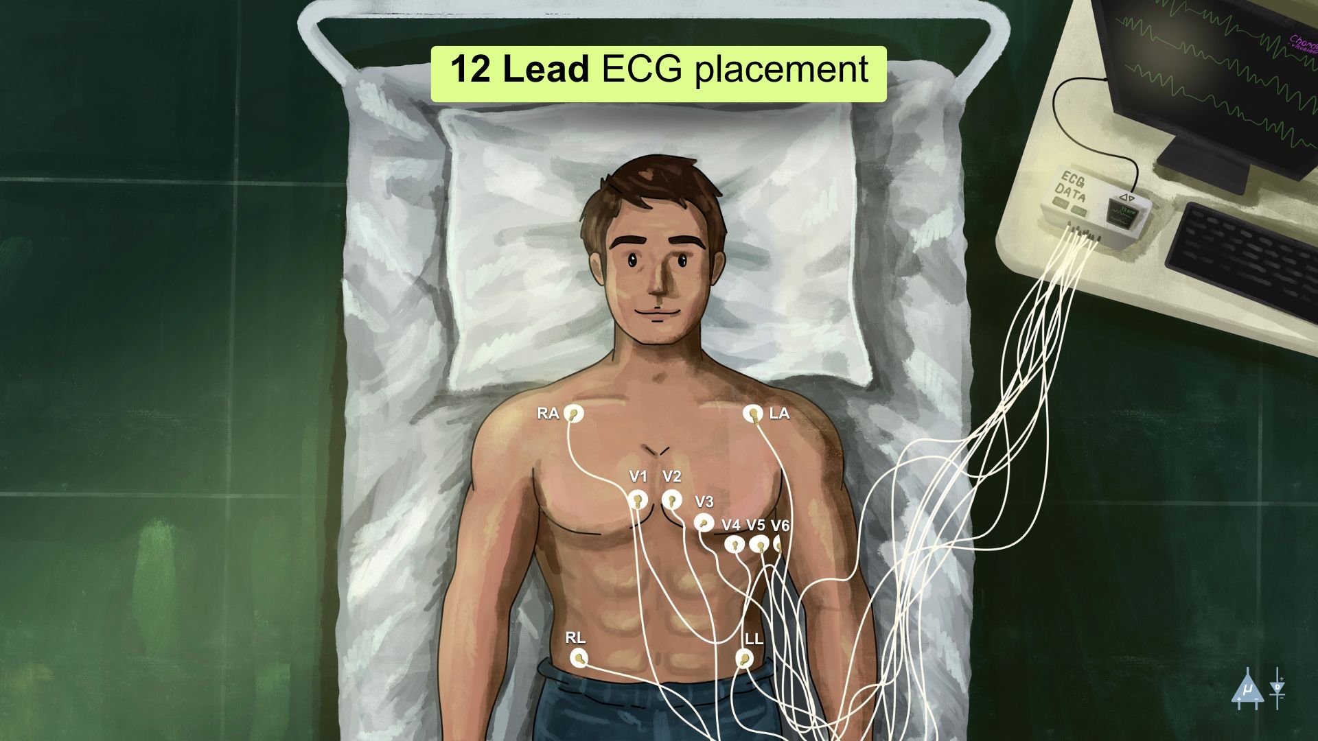 ECG Leads Placement