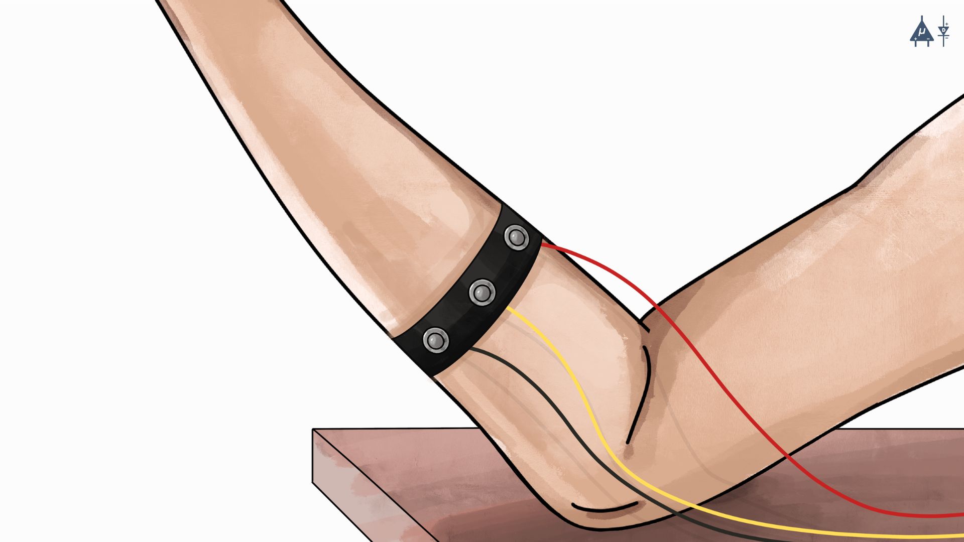 EMG Dry Electrode Placement