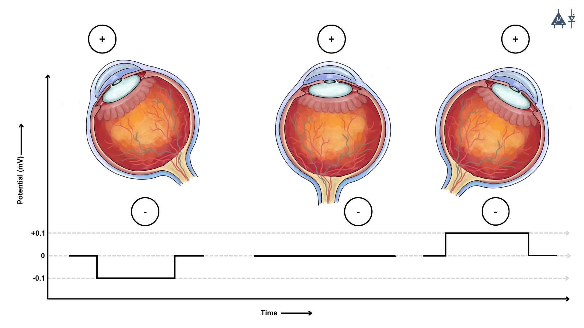 EOG Signal Detection