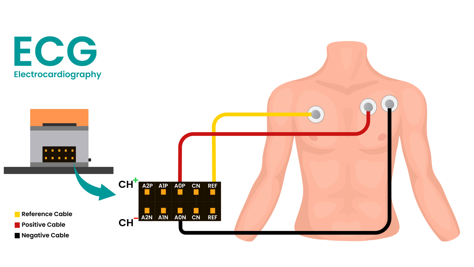Chest electrode placement diagram: the yellow reference, red positive and black negative cables run from the NPG Lite connector to three electrodes on the chest