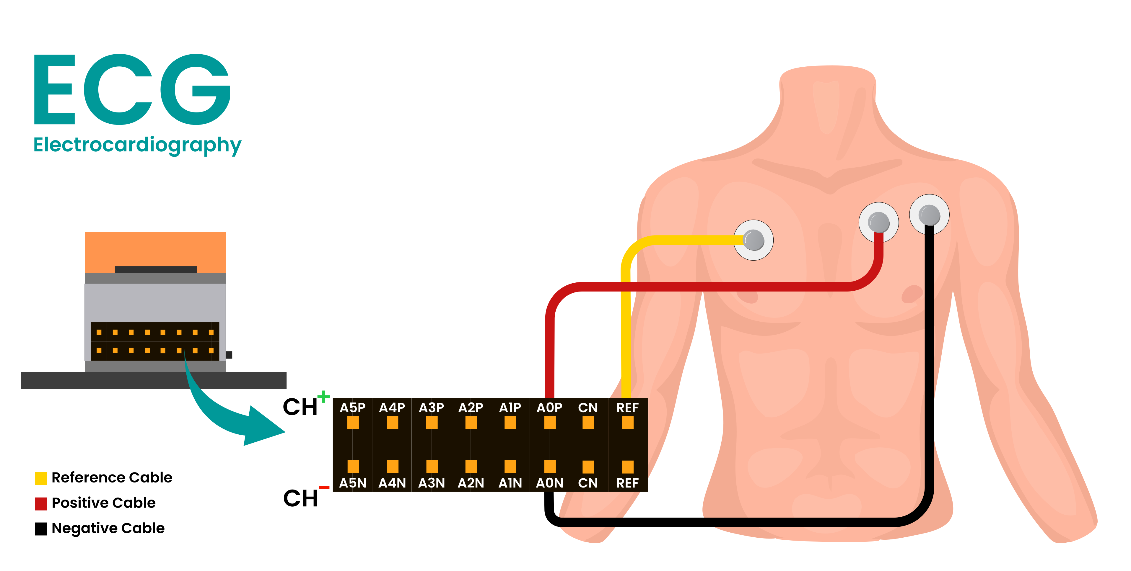 ECG placement diagram with the negative and positive electrodes on the upper chest, and the reference electrode on the right chest