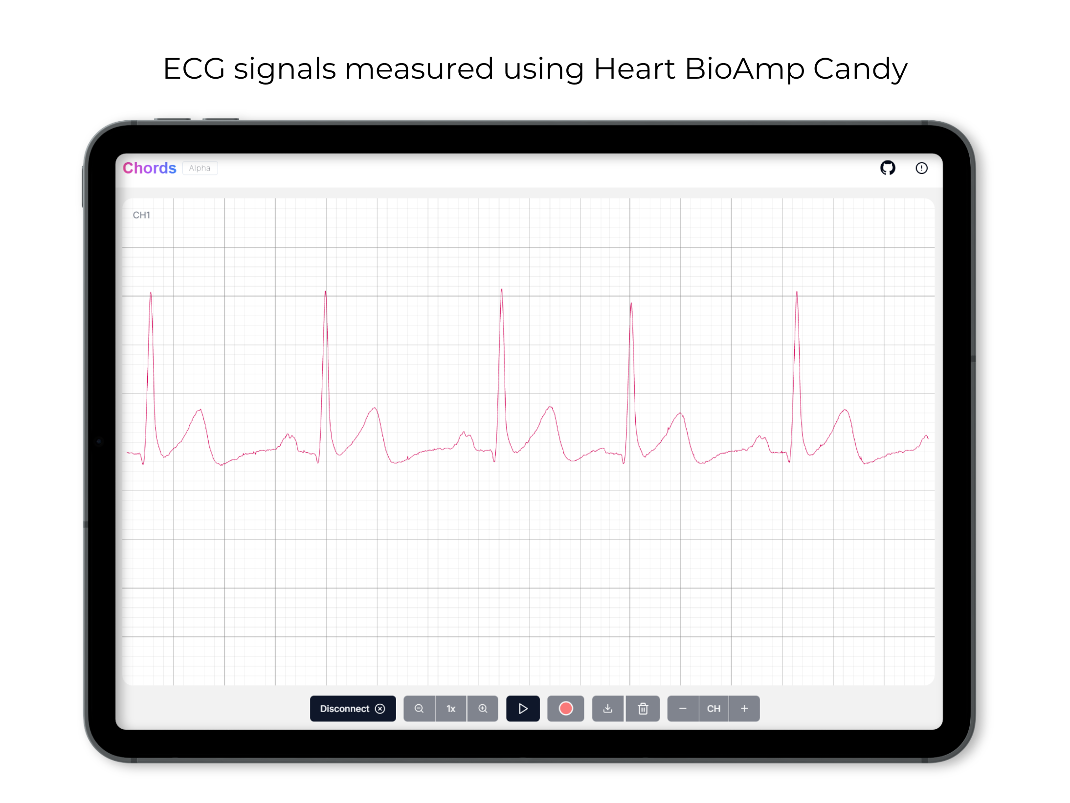 ECG signals using Heart BioAmp Candy