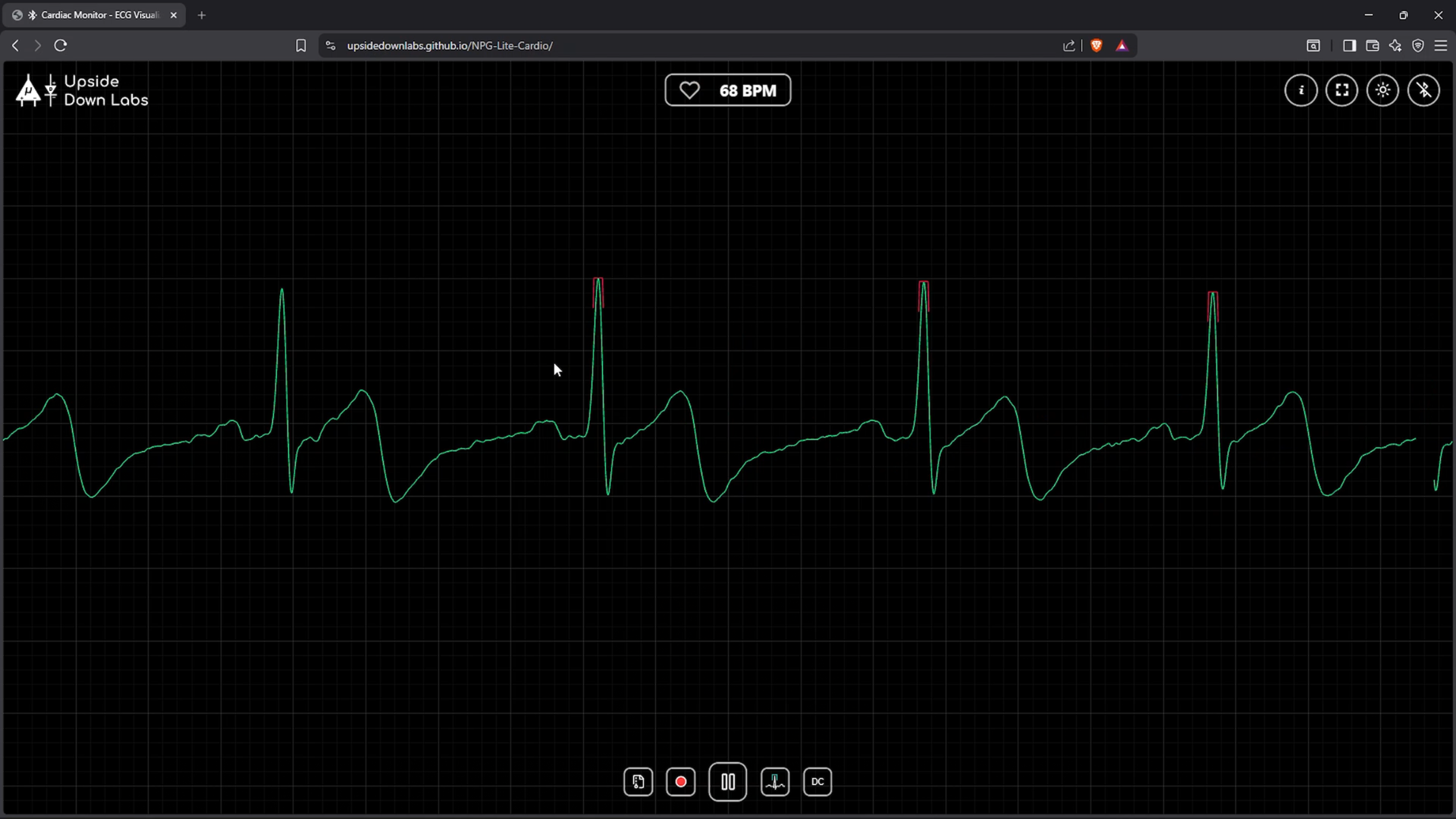 Live ECG waveform with a heart rate of 68 BPM and red markers on the R-peaks