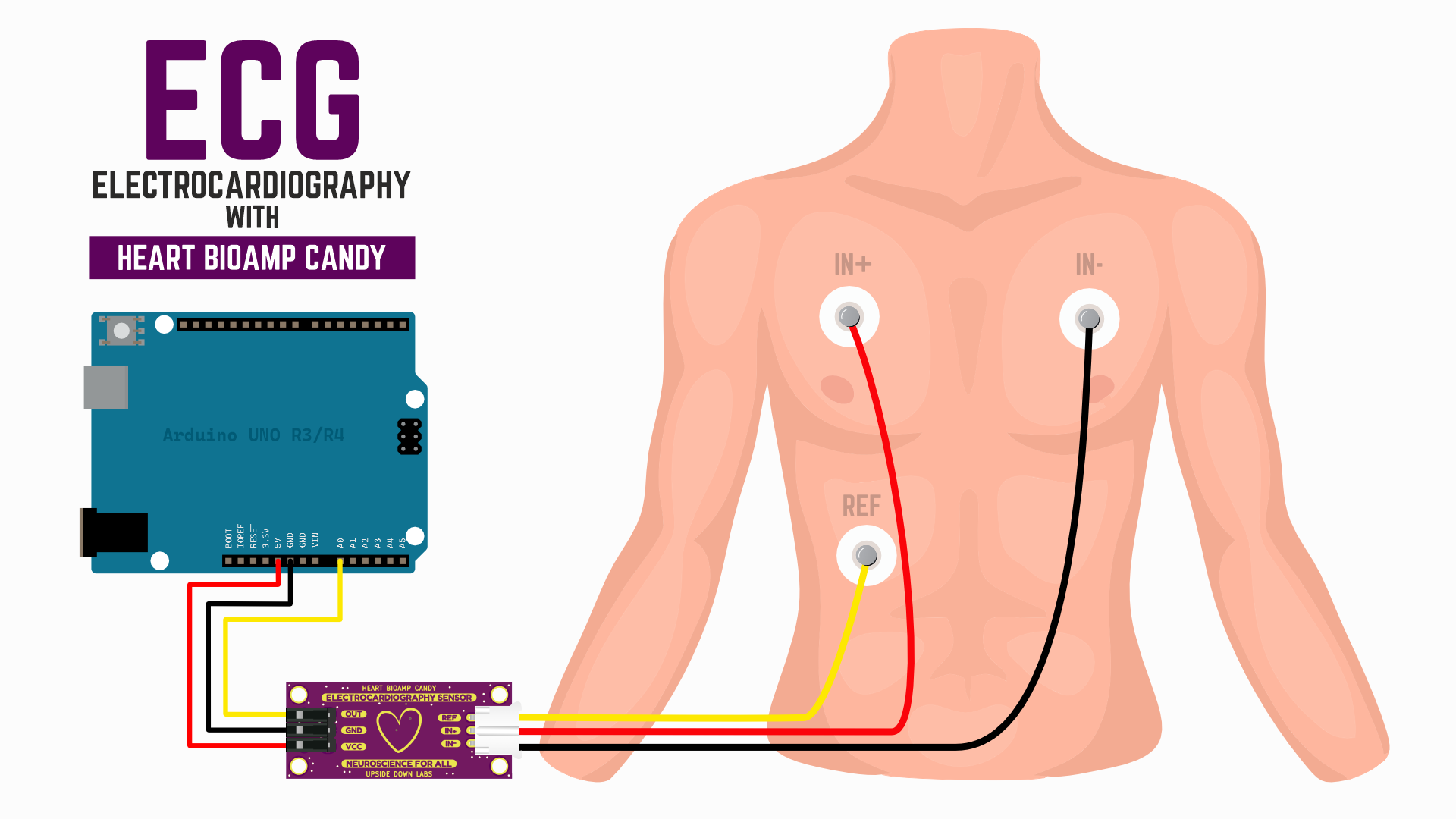 Using Heart BioAmp Candy to measure ECG with gel electrodes