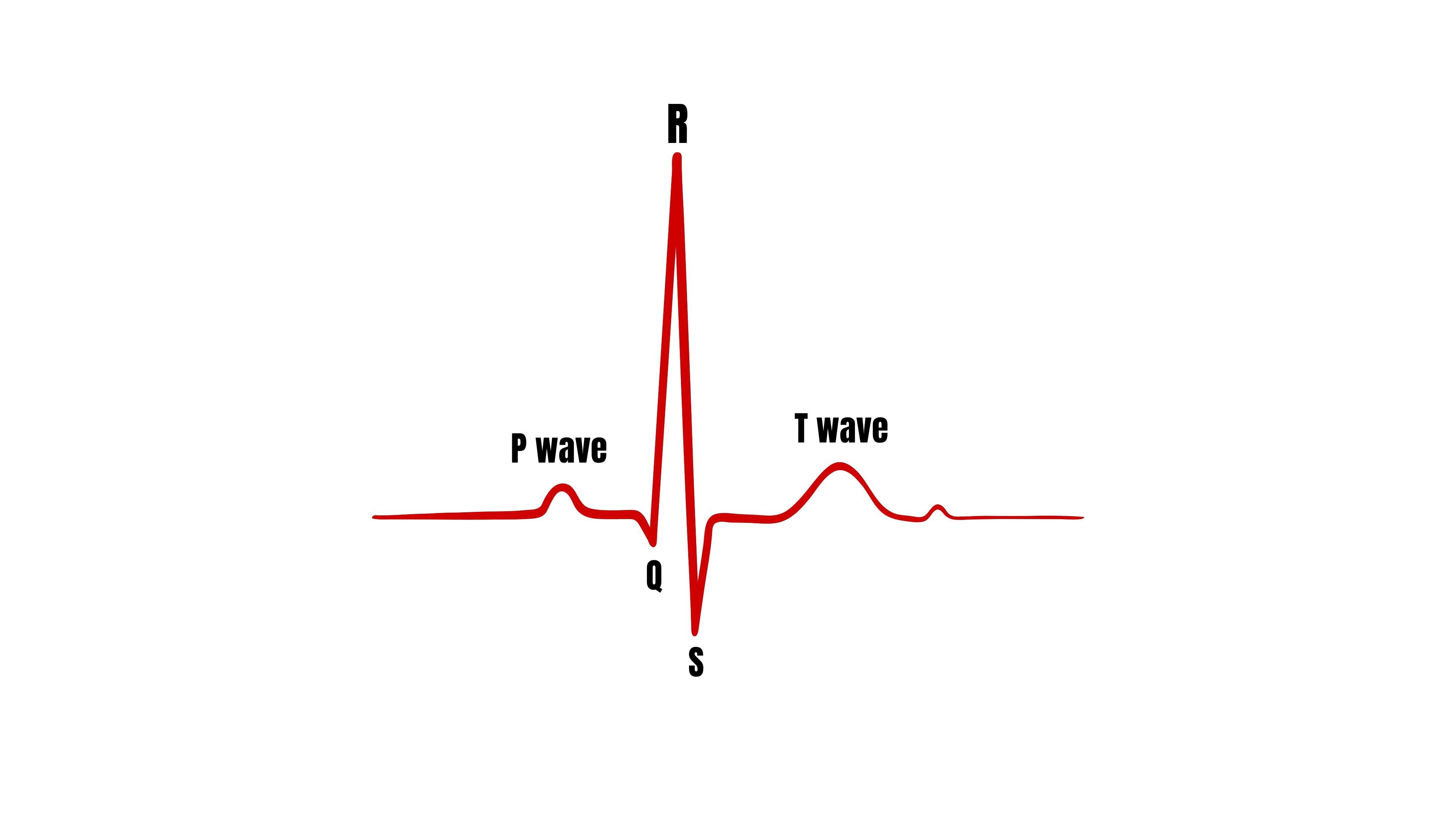 ECG waveform with the P wave, the Q, R and S points of the QRS complex, and the T wave labeled