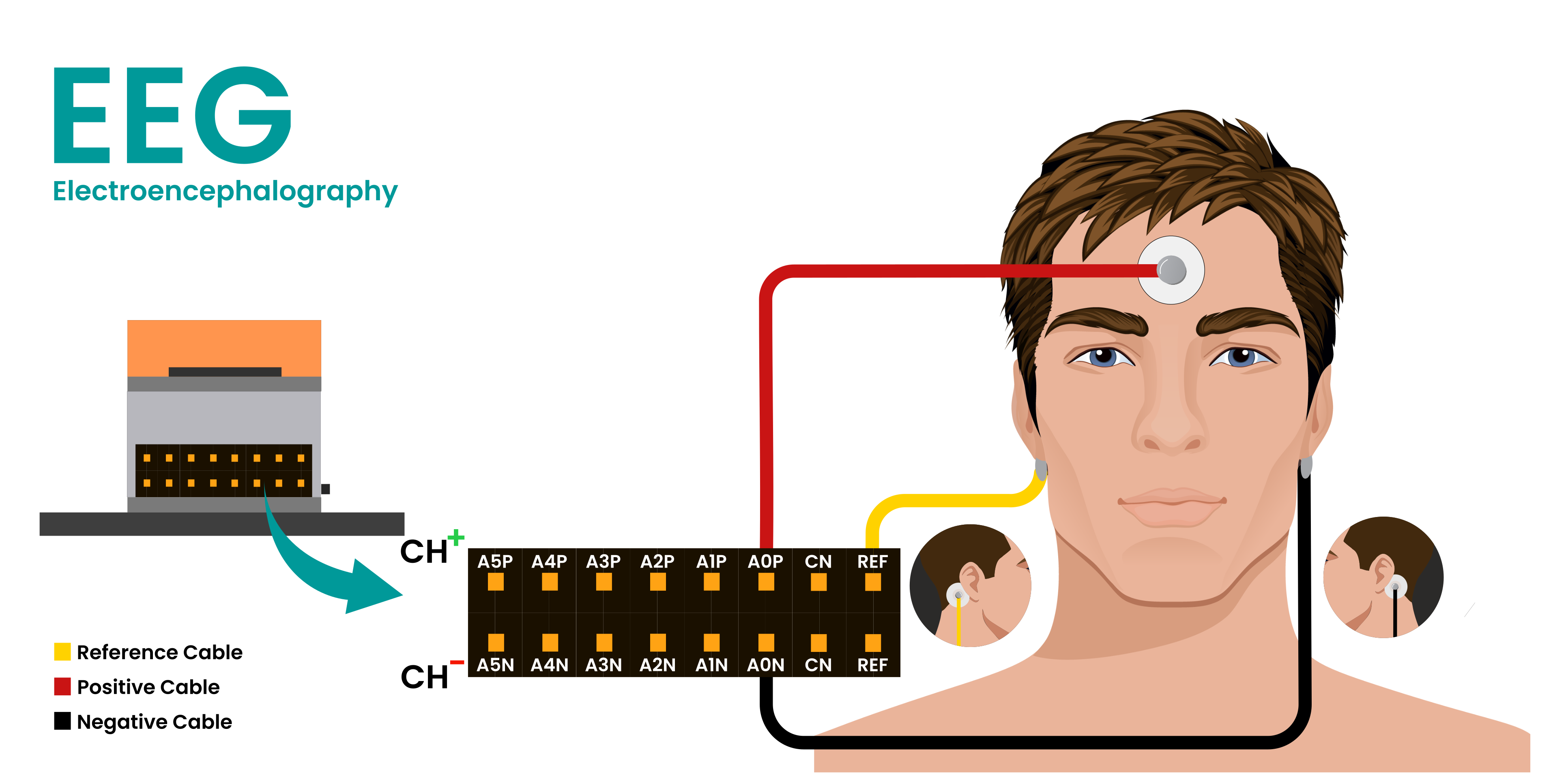 Electrode placement diagram with IN+ on the forehead, IN- behind one ear, and REF behind the other ear