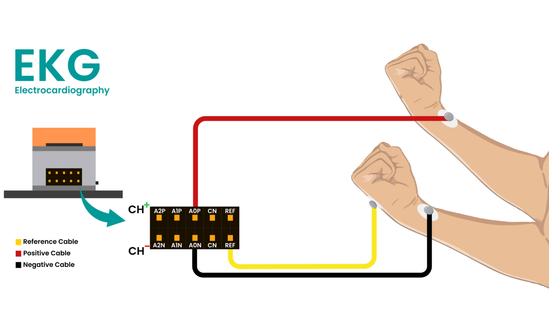 Wrist electrode placement diagram: the red positive cable goes to one wrist, the black negative cable to the other wrist, and the yellow reference cable to the back of the hand