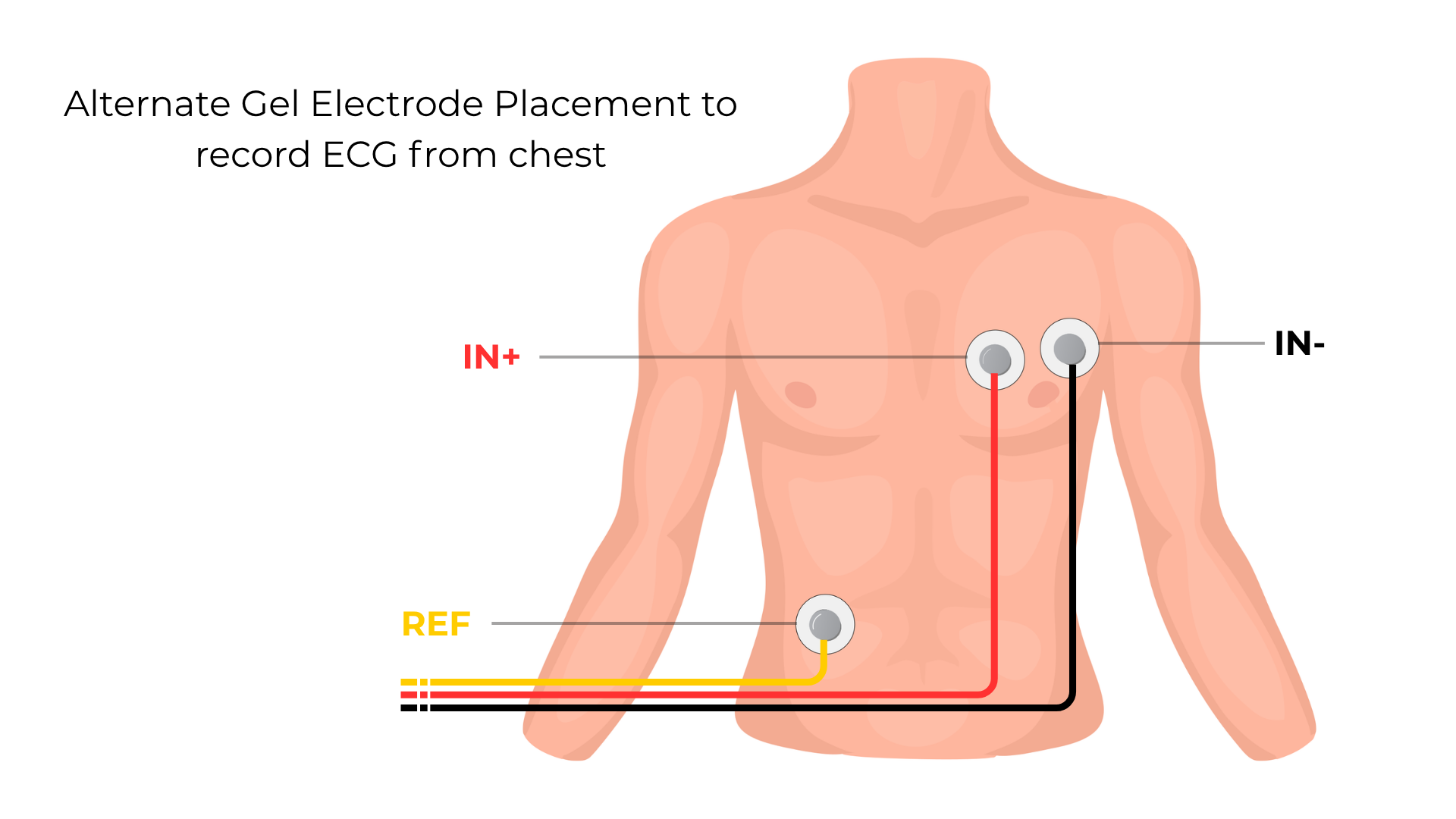 ECG Placement for Breathe Monitor