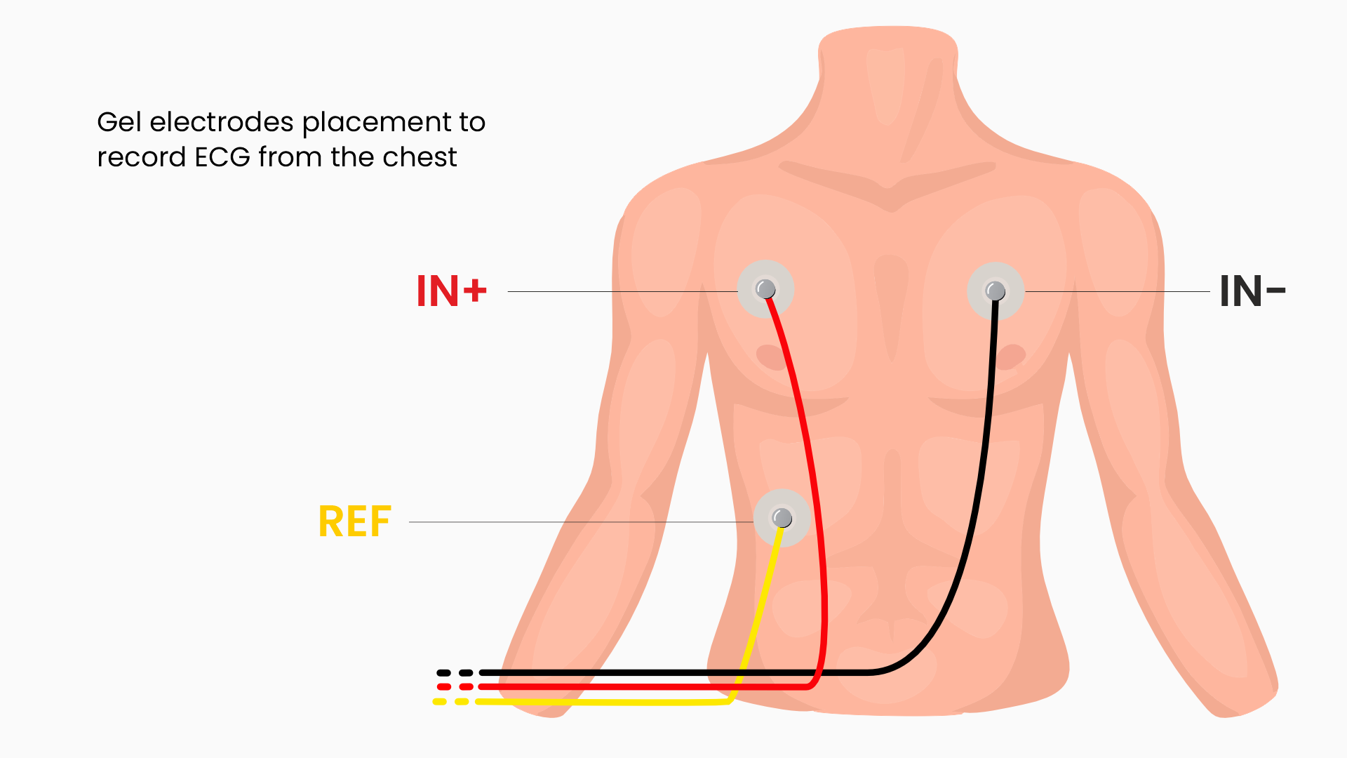 Electrode placement for ECG