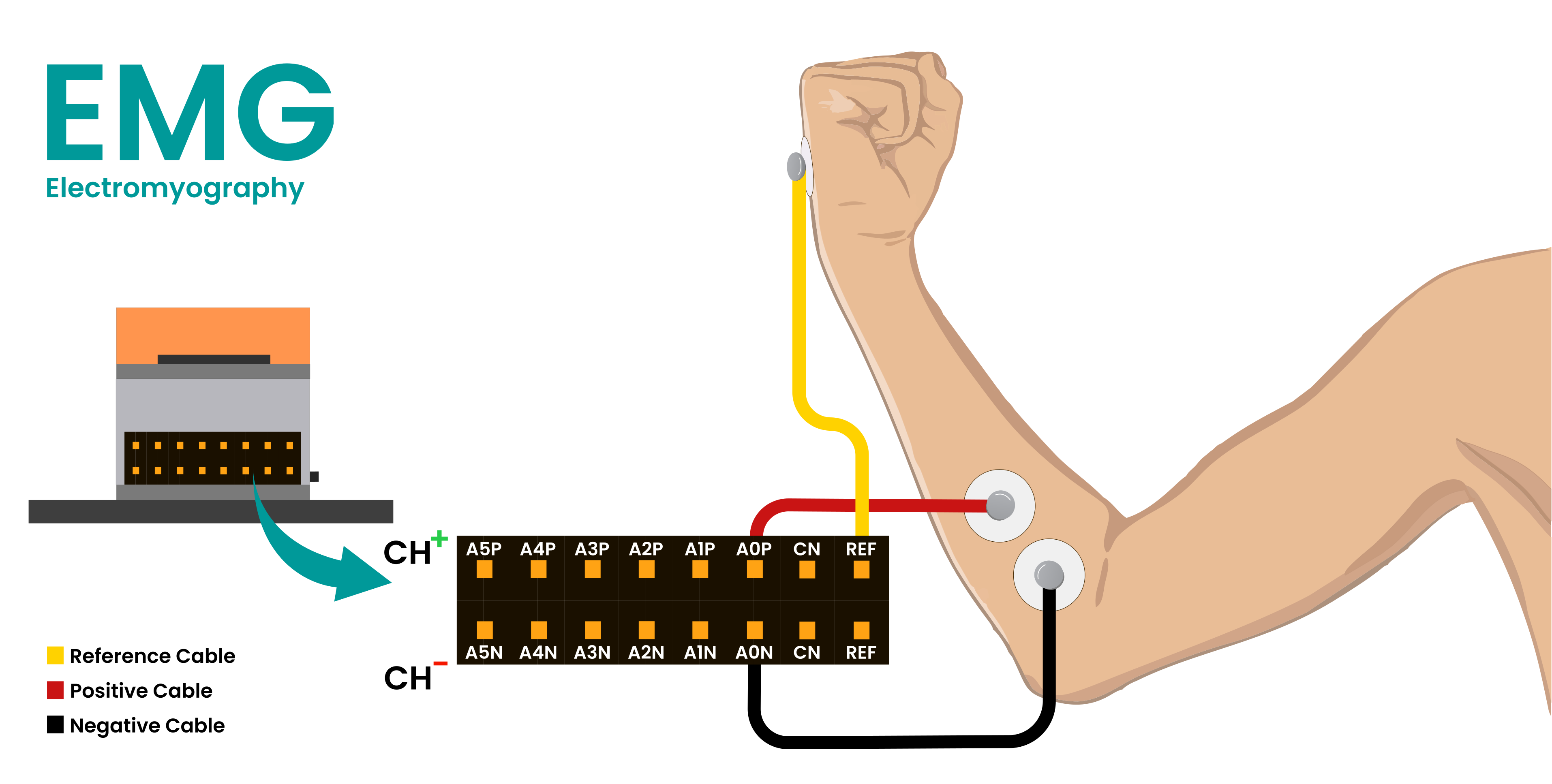 EMG placement diagram with the positive and negative electrodes on the forearm, and the reference electrode on the wrist