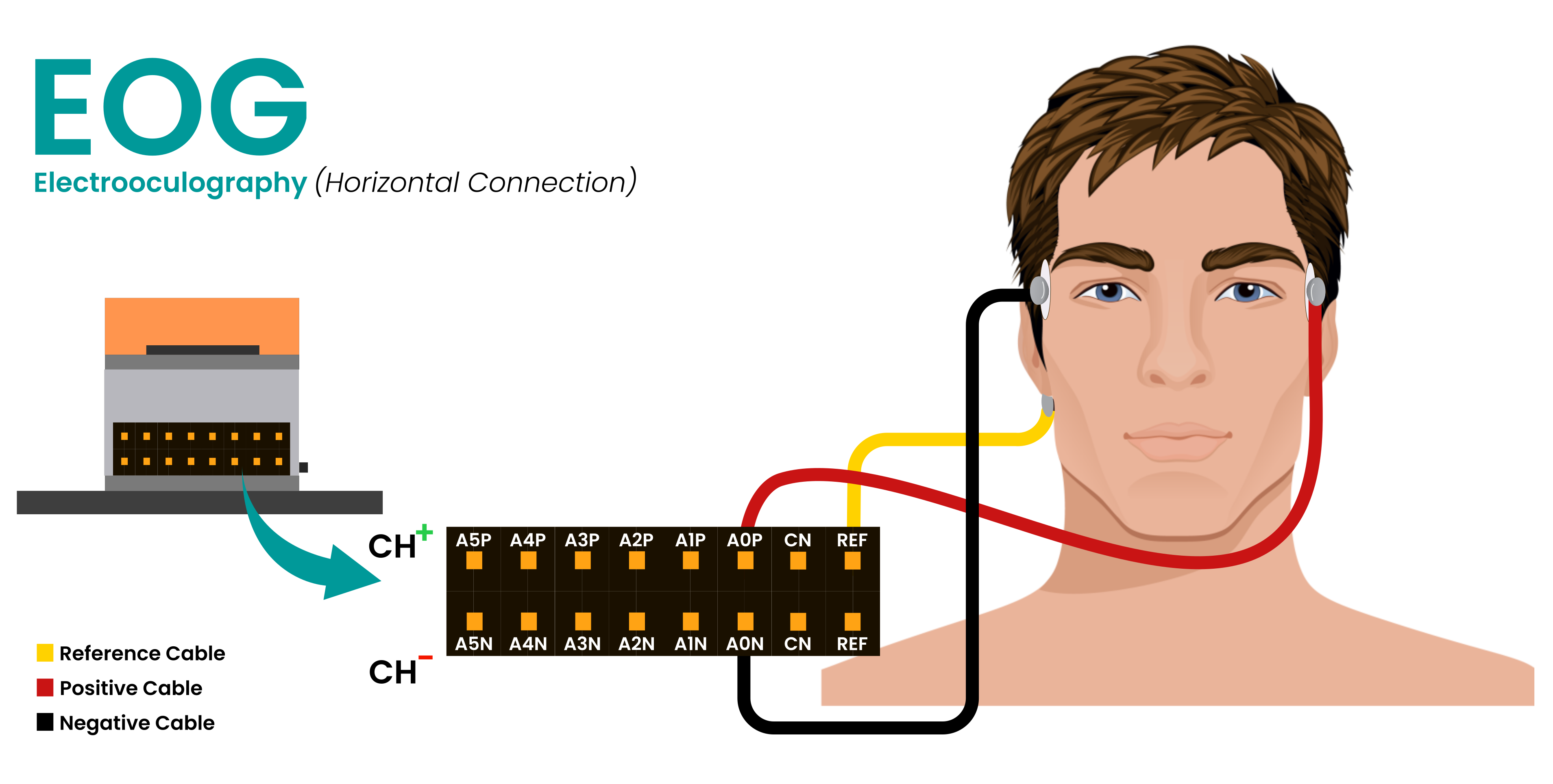 EOG placement diagram with the negative and positive electrodes at the outer corners of the eyes, and the reference electrode near the ear