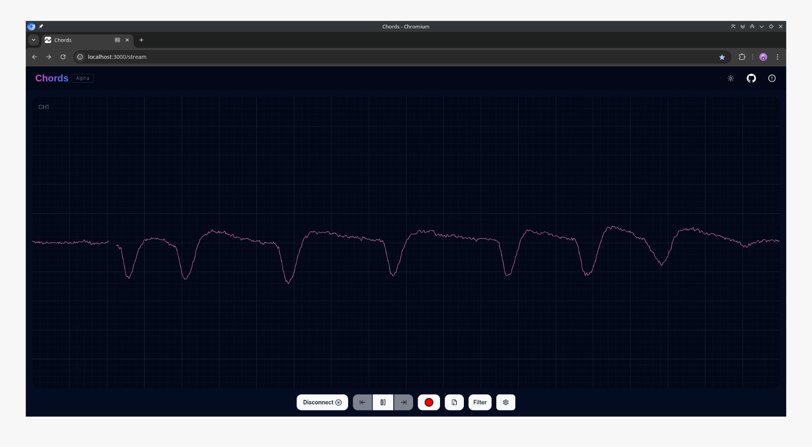 Eye blink waveform