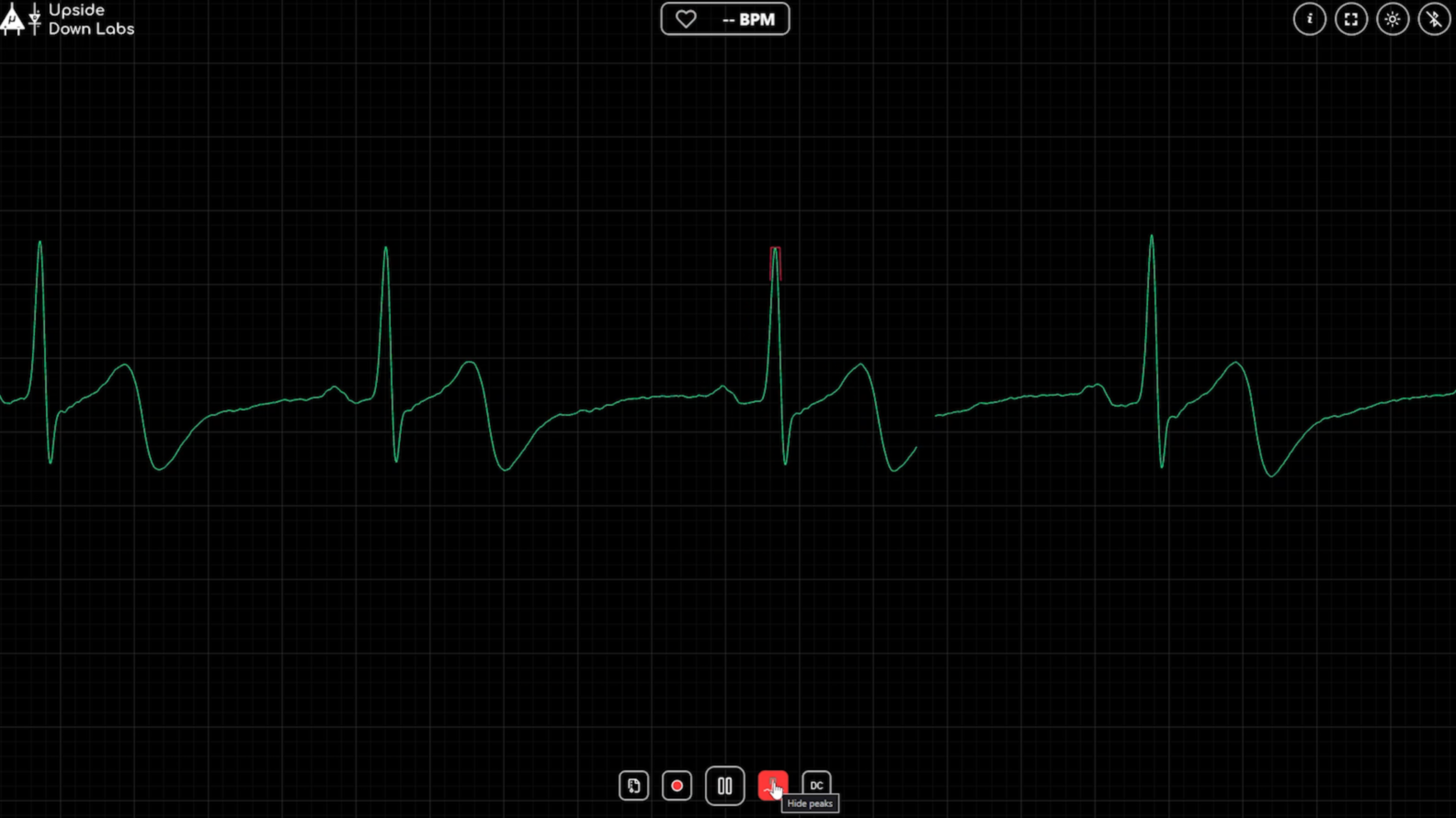 The Peaks button highlighted with its Hide peaks tooltip