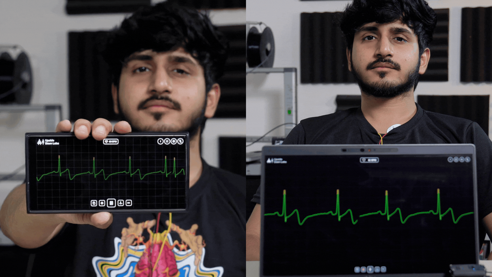 NPG-Lite Cardio running on a phone and a laptop, each showing a live ECG waveform and heart rate
