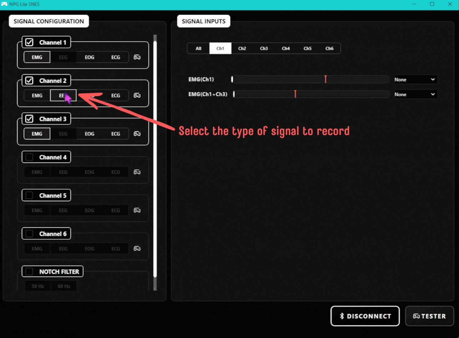 Signal type buttons (EMG, EEG, EOG, ECG) under each ticked channel