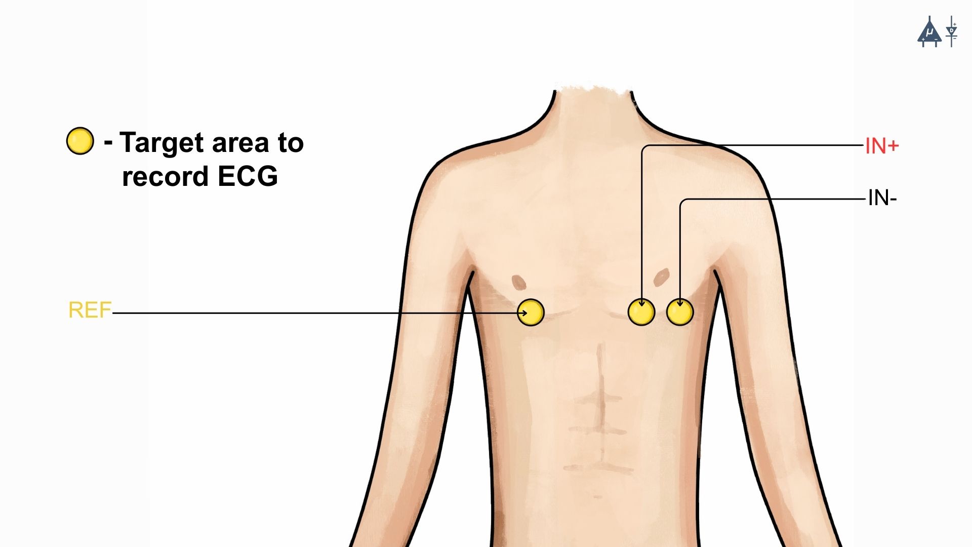 ECG Placement