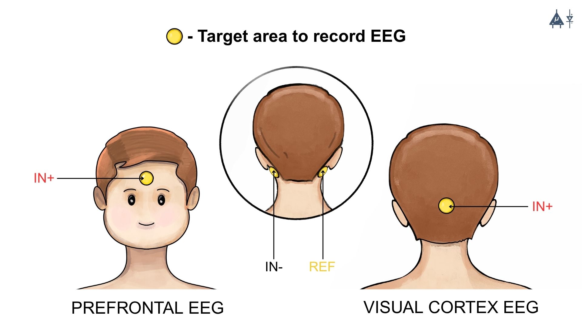 ../../../_images/skin-prep-eeg.jpeg