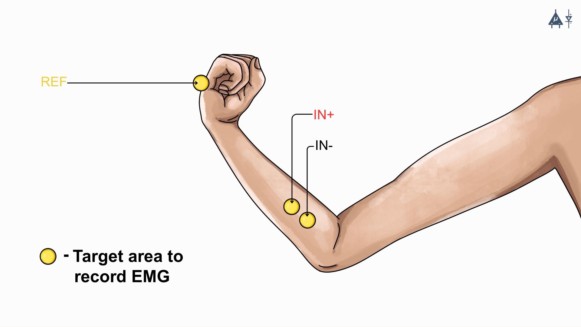 EMG Placement